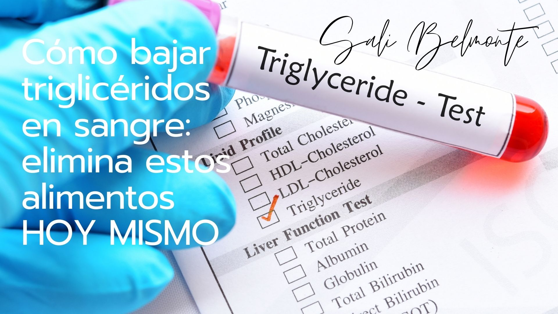 Cómo bajar triglicéridos en sangre: elimina estos alimentos HOY MISMO